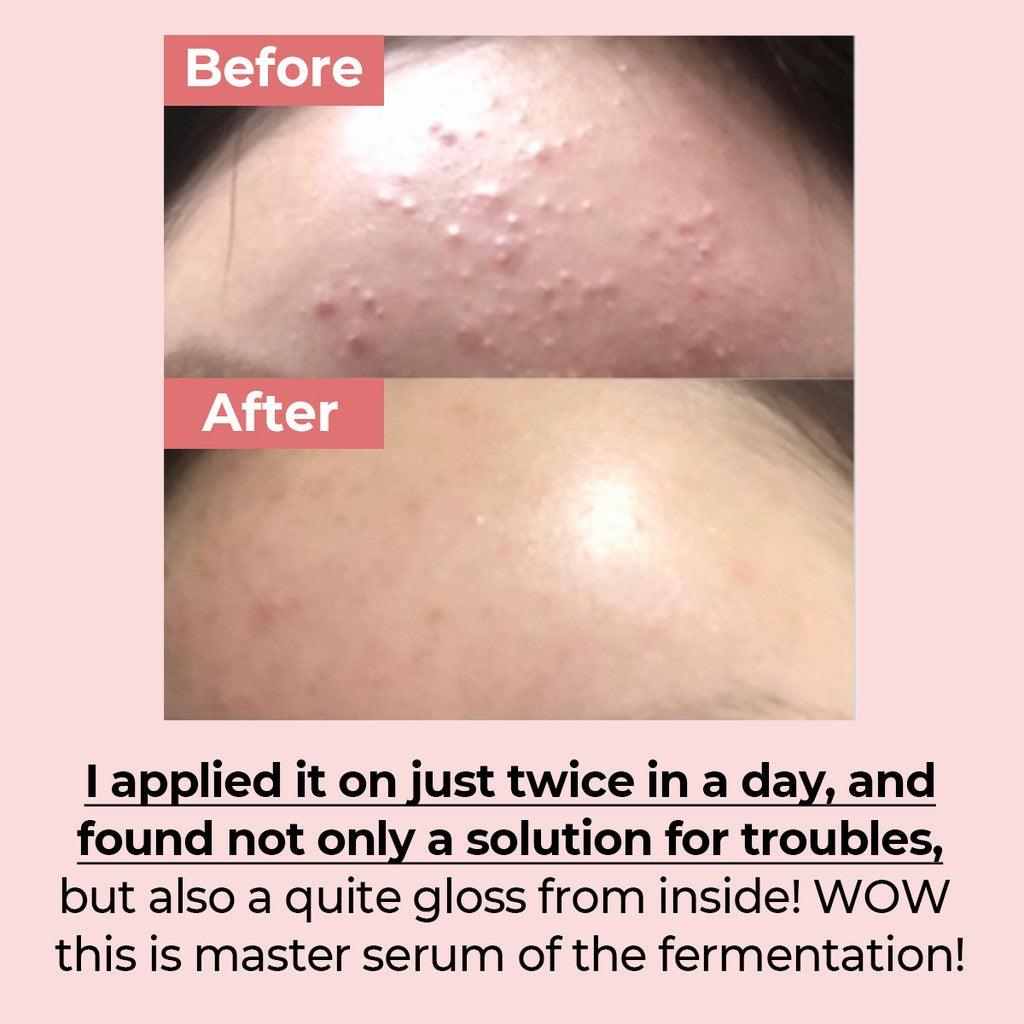 NUMBUZIN No.3 Skin Softening Serum