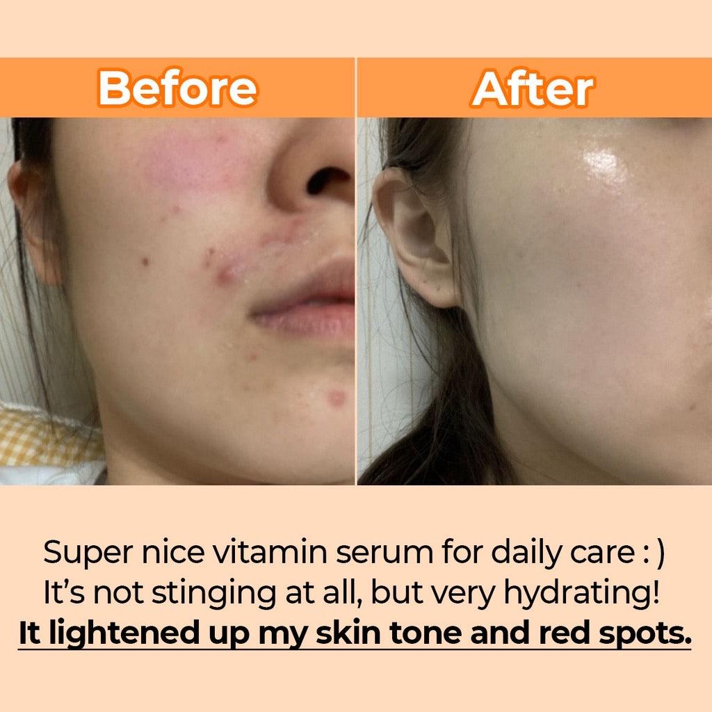 NUMBUZIN No.5 Goodbye Blemish Serum