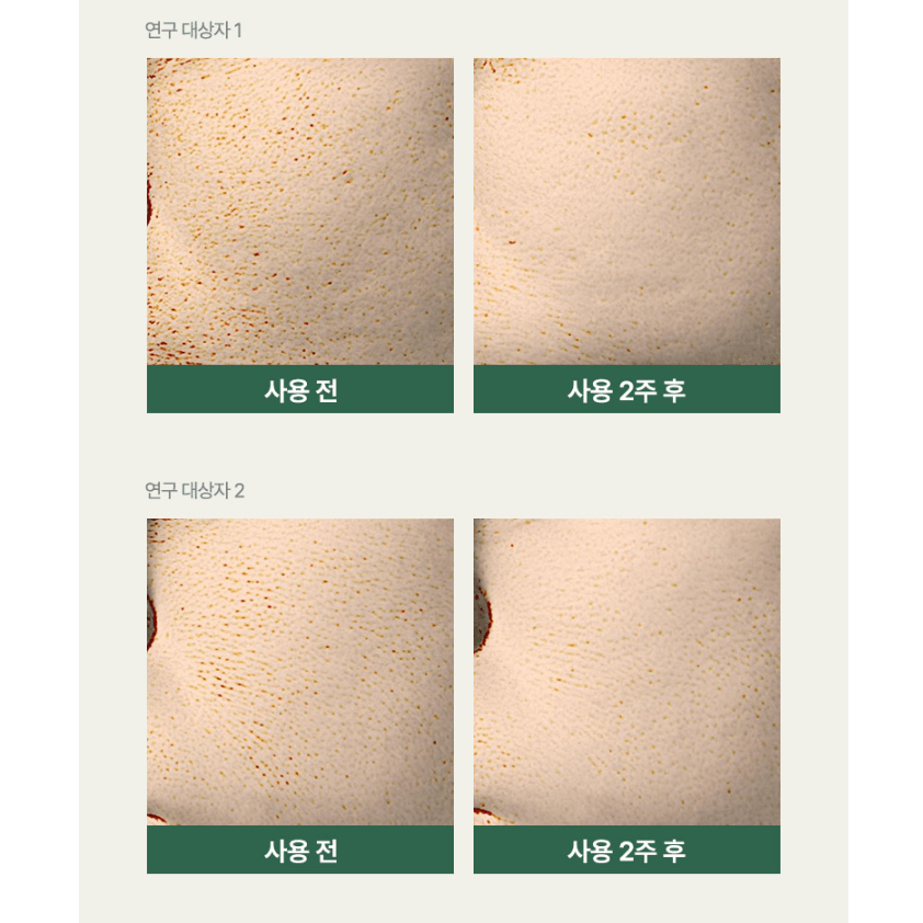 Anua Heartleaf 77 透明护垫双包(70+70 护垫补充装)