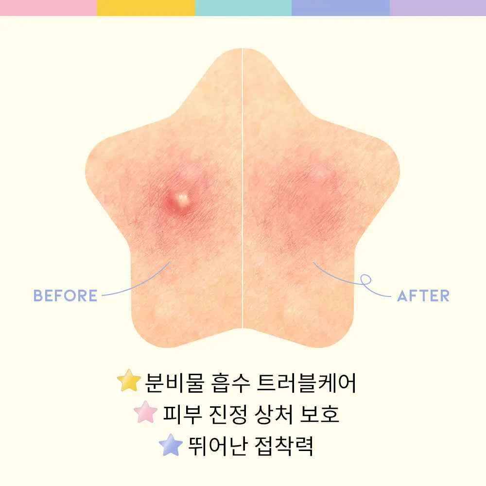 OOTD Twinkle Little Star Acne Spot Patch (80 items)